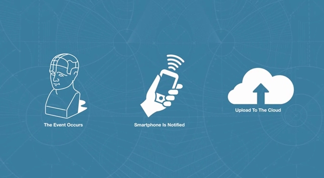 concussion detection