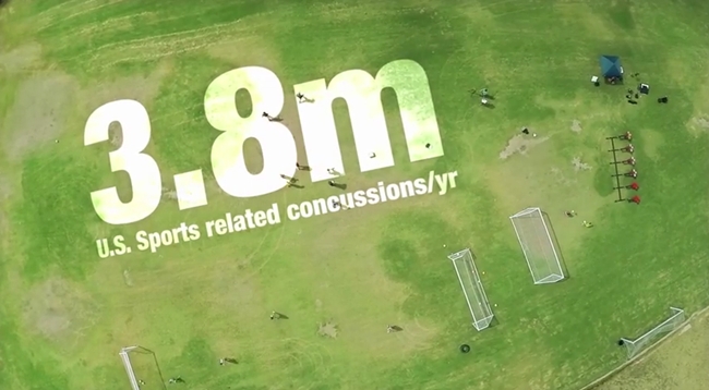 concussion detection